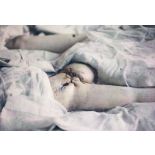 Hôpital du Grand Palais, service du docteur Laurent, opération de la greffe d'os, les deux soldats 8 jours après l'opération, gros plan sur la greffe. [légende d'origine]