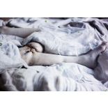 Hôpital du Grand Palais, service du docteur Laurent, opération de la greffe d'os, les deux soldats 8 jours après l'opération, gros plan sur la greffe. [légende d'origine]