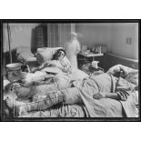 Paris. Hôpital du Grand Palais. Opération de la greffe osseuse par le Docteur Laurent. Les deux opérés, 2 jours après l'opération. [légende d'origine]