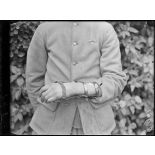 Montpellier. Centre neurologique de la 16e Région. Paralysie radiale gauche. [légende d'origine]