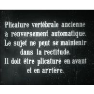 Plicature vertébrale ancienne à renversement automatique. Le sujet ne peut se maintenir dans la rectitude.