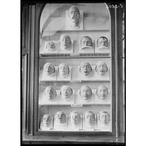 Val de Grâce. Salle Anatomoclinique. Un panneau de têtes (moulages du docteur Morestin). [légende d'origine].