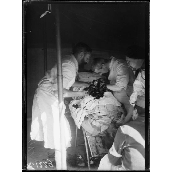 Sopotznni. Ambulance de colonne mobile n°1. Entéro anastomose par application du bouton de Murphy, à la suite d'une plaie de l'abdomen par balle de fusil. [légende d'origine]