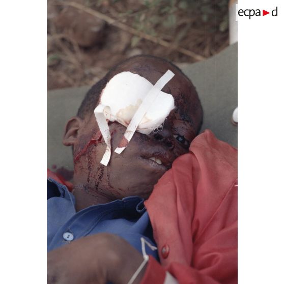 Portrait d'un enfant avec un bandage à l'oeil, lors de l'évacuation sanitaire de ressortissants rwandais blessés de Kibeho par l'élément militaire médical d'intervention rapide (EMMIR).