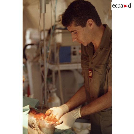 Opération chirurgicale d'une enfant mutilée de la jambe menée par le médecin principal Rigal, orthopédiste à l'hôpital Bégin, sous une tente du service des urgences de l'antenne médicale de Goma.