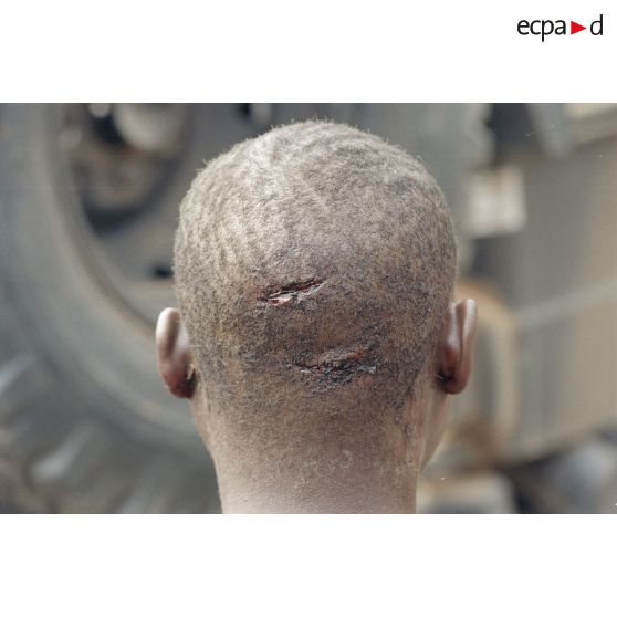 Entailles et traces de coups de machette sur le crâne d'un enfant rwandais au campement du commandement des opérations spéciales (COS) à Gikongoro.