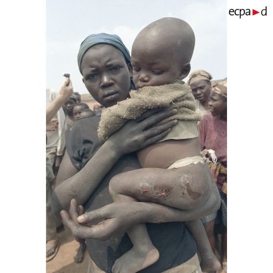 Une femme porte dans ses bras un petit enfant présentant des meurtrissures à la cuisse à Kibeho.