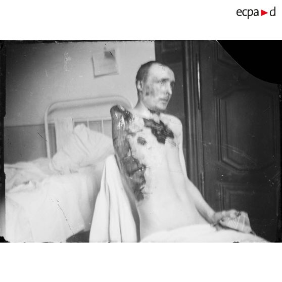 [Portrait d'un blessé amputé d'un bras, s.d.]