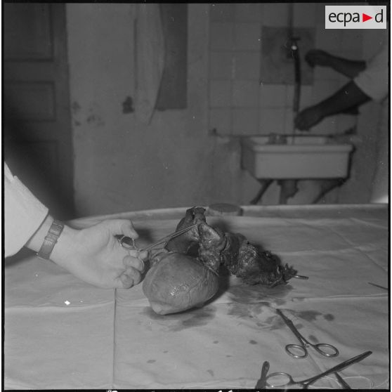 Dissection d'un cœur d’animal. [Description en cours]