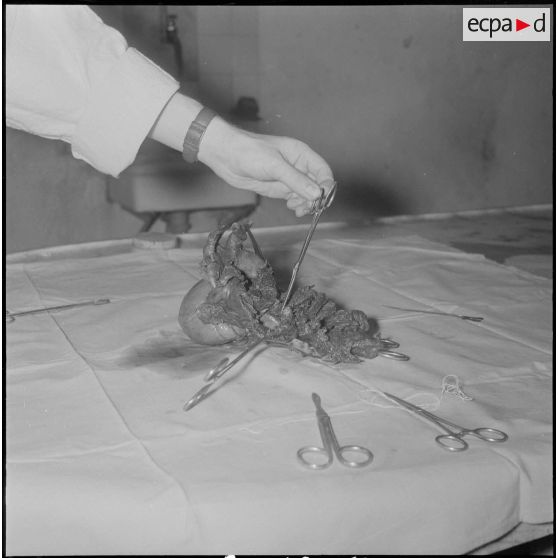 Dissection d'un cœur d’animal. [Description en cours]