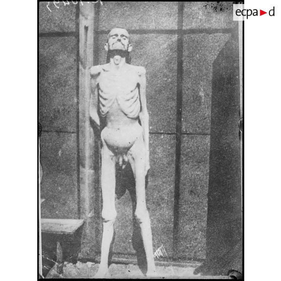 Corfou. Après la retraite serbe. Un squelette vivant. [légende d'origine]