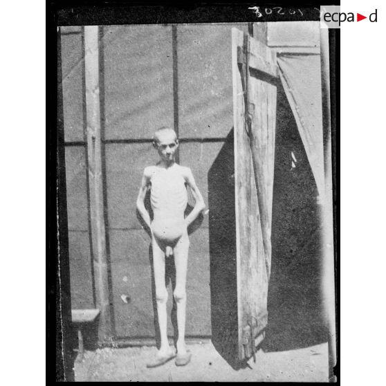 Corfou. Après la retraite. Un serbe squelette vivant. [légende d'origine]