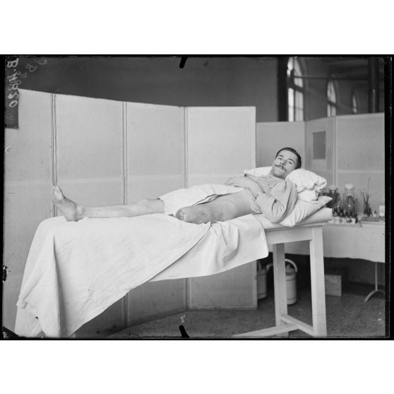 Paris, hôpital du Grand Palais. Soldat à qui l'on a coupé un morceau d'os du moignon cicatriciel pour le greffer à la jambe d'un camarade. [légende d'origine]