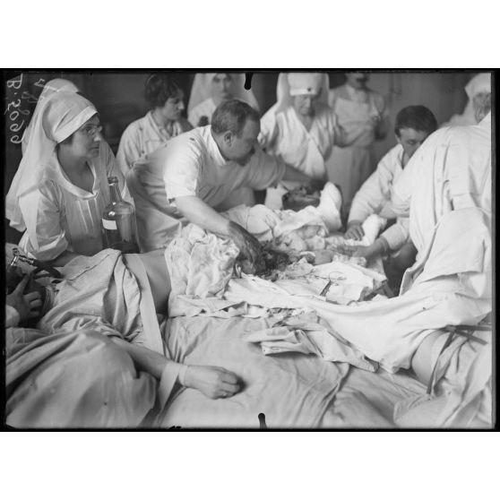 Paris. Hôpital du grand palais - Opération de la greffe osseuse par le docteur Laurent. Deuxième et dernière phase de l'opération. [légende d'origine]