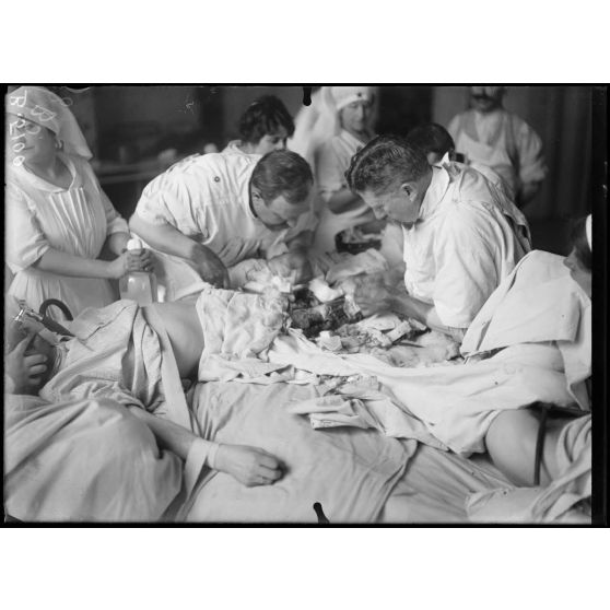 Paris. Hôpital du grand palais - Opération de la greffe osseuse par le docteur Laurent. Deuxième et dernière phase de l'opération. [légende d'origine]