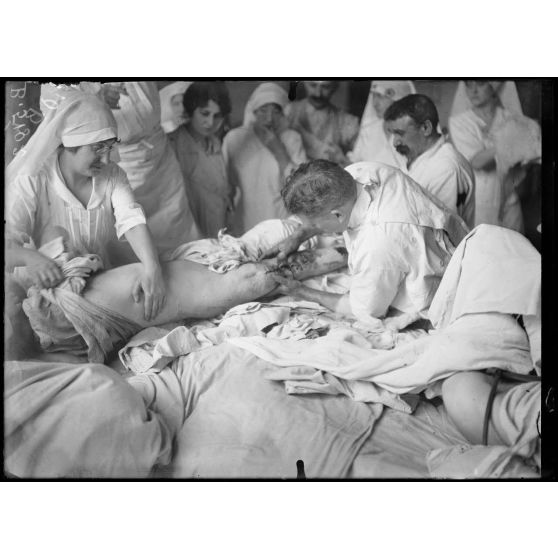 Paris. Hôpital du grand palais - Opération de la greffe osseuse par le docteur Laurent. Deuxième et dernière phase de l'opération. [légende d'origine]