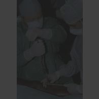 Mise en place d'une broche sur la jambe du patient lors de l'opération chirurgicale en coopération franco-israélienne à Goma.