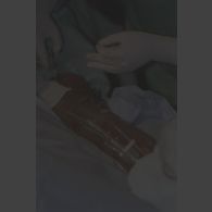 Mise en place d'une broche sur la jambe du patient lors de l'opération chirurgicale en coopération franco-israélienne à Goma.