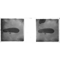 [Jules, saucisse d'observation].