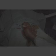 Opération chirurgicale sur la jambe transpercée par une balle d'une personne rwandaise au campement de l'élément militaire médical d'intervention rapide (EMMIR) à Cyangugu. Une mèche a été introduite dans le trou.