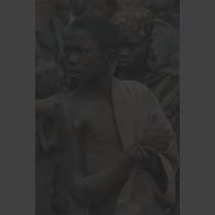 Portrait d'un enfant au bras blessé et infecté au camp de réfugiés de Kibeho lors d'une opération d'évacuation des blessés effectuée par le commandement des opérations spéciales (COS) et l'élément militaire médical d'intervention rapide (EMMIR).